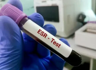 Study Examines Whether Dropping ESR Tests Actually Lowers Costs