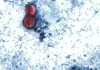 What To Know About Cyclospora, The Gut-Churning Parasite Causing Illness In Several States, And How To Avoid It