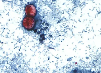 What To Know About Cyclospora, The Gut-Churning Parasite Causing Illness In Several States, And How To Avoid It