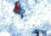 First Deaths Reported In Cyclosporiasis Outbreak