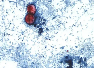 First Deaths Reported In Cyclosporiasis Outbreak