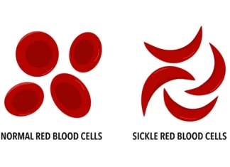 Sickle Cell Awareness Month Highlights Importance Of Understanding Disease, Trait And Treatment